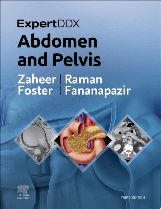 ExpertDDx: Abdomen and Pelvis, 3rd Edition
