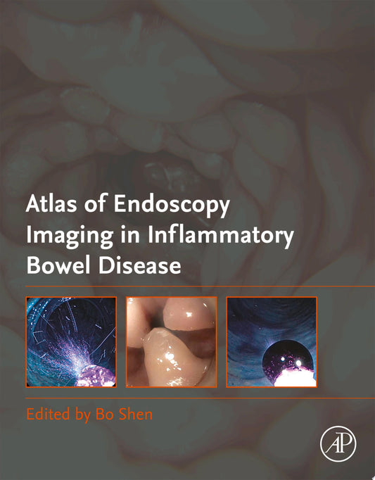 Atlas of Endoscopy Imaging in Inflammatory Bowel Disease