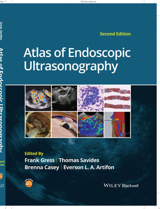 Atlas of Endoscopic Ultrasonography, 2nd Edition