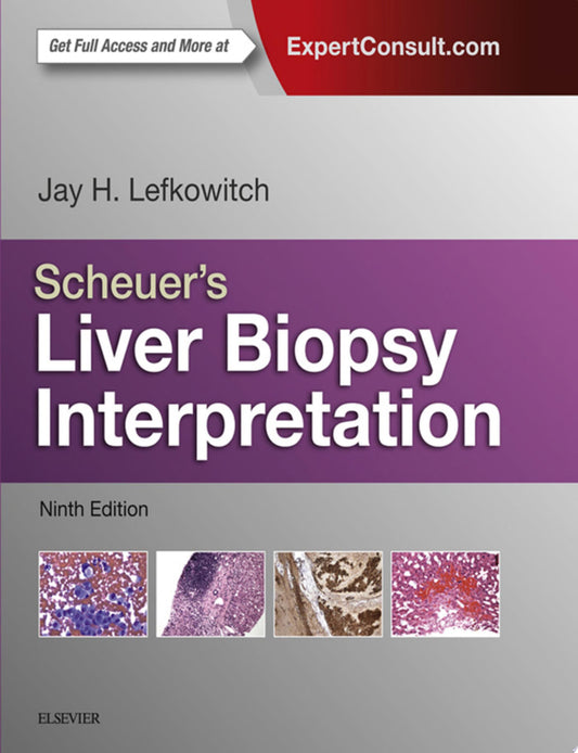 Scheuer’s Liver Biopsy Interpretation, 10th Edition