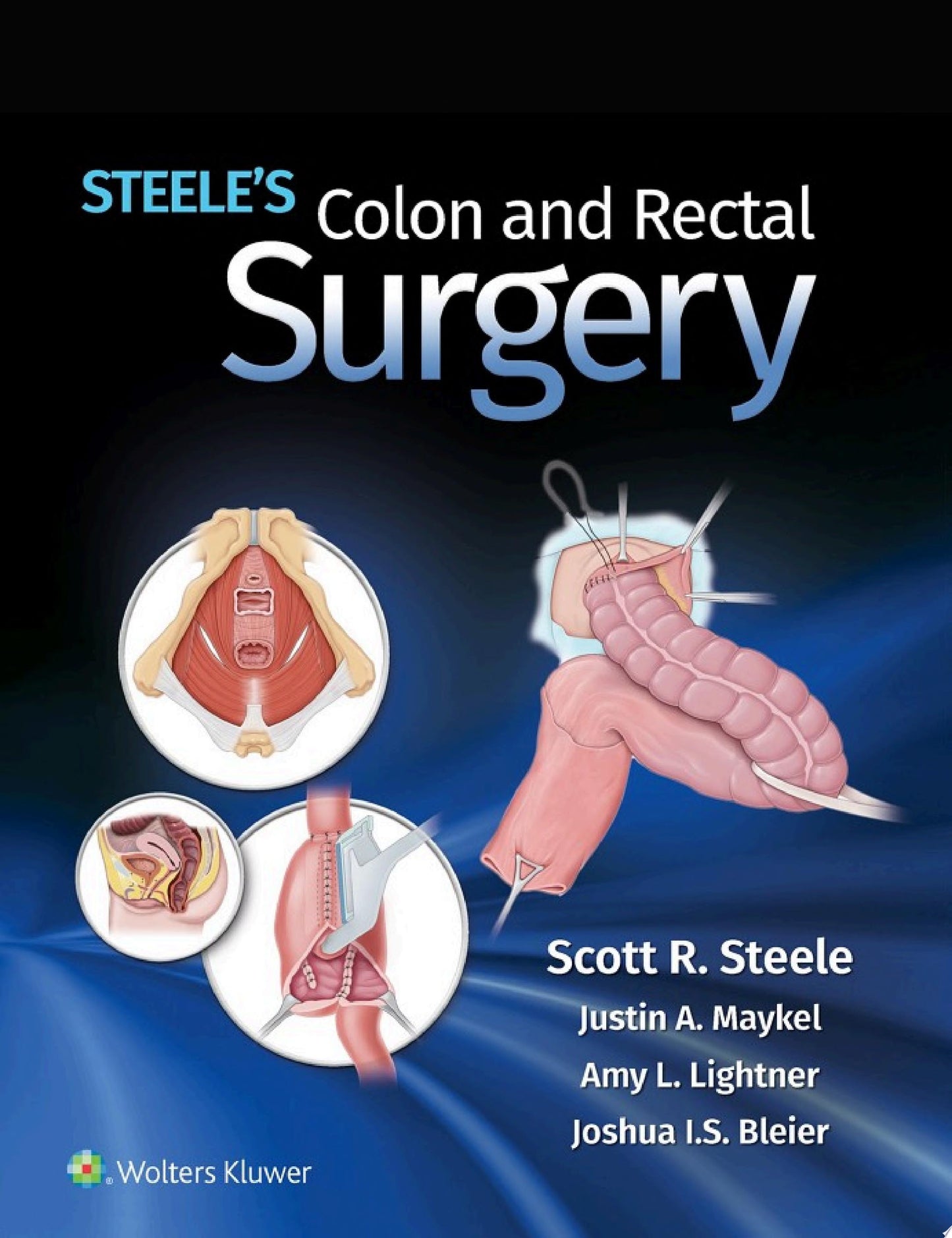 Steele’s Colon and Rectal Surgery