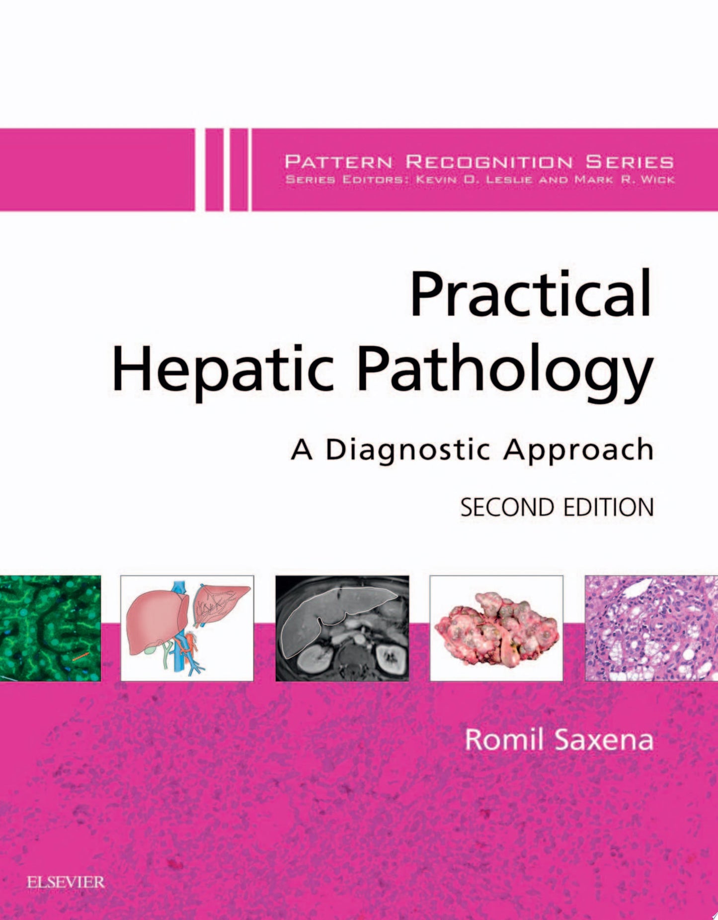 Practical Hepatic Pathology: A Diagnostic Approach: A Volume in the Pattern Recognition Series, Expert Consult: Online and Print