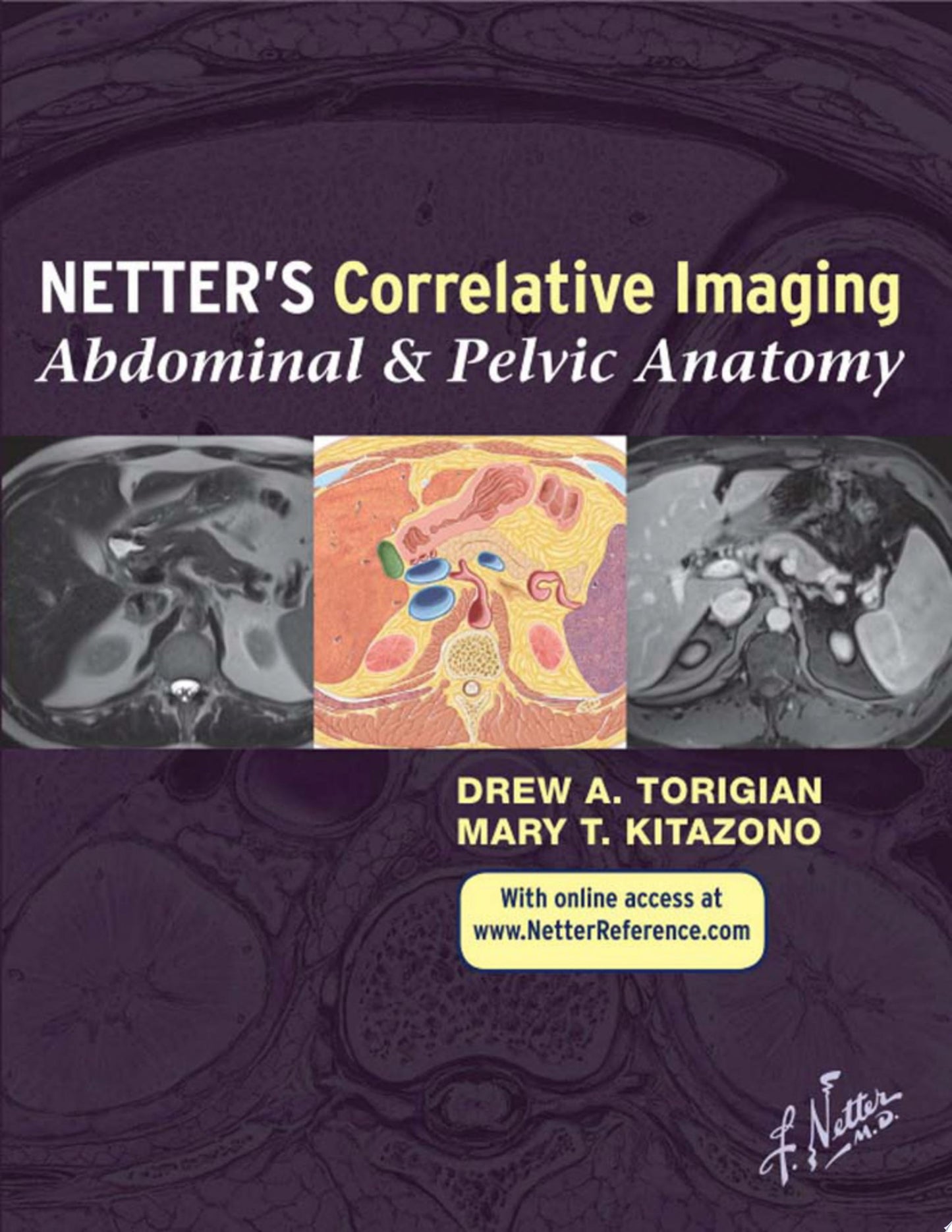 Netter’s Correlative Imaging: Abdominal and Pelvic Anatomy